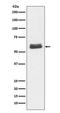 Caspase 10 antibody, M02190-1, Boster Biological Technology, Western Blot image 