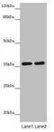 G Protein Subunit Beta 1 Like antibody, LS-C675820, Lifespan Biosciences, Western Blot image 