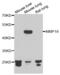 Matrix Metallopeptidase 19 antibody, abx005103, Abbexa, Western Blot image 