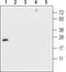 Ciliary Neurotrophic Factor antibody, TA328702, Origene, Western Blot image 