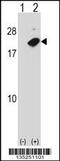 Nudix Hydrolase 2 antibody, 58-275, ProSci, Western Blot image 