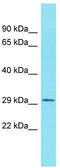 Glycoprotein Integral Membrane 1 antibody, TA333532, Origene, Western Blot image 