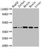 Isocitrate Dehydrogenase (NAD(+)) 3 Alpha antibody, LS-C670518, Lifespan Biosciences, Western Blot image 