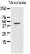 Homer Scaffold Protein 1 antibody, GTX50022, GeneTex, Western Blot image 