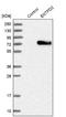 Ectonucleoside Triphosphate Diphosphohydrolase 2 antibody, NBP1-85752, Novus Biologicals, Western Blot image 