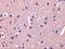 Collapsin Response Mediator Protein 1 antibody, GTX31288, GeneTex, Immunohistochemistry paraffin image 