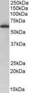 Negative Elongation Factor Complex Member C/D antibody, NBP1-52112, Novus Biologicals, Western Blot image 