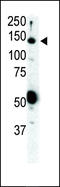 Ret Proto-Oncogene antibody, 63-124, ProSci, Western Blot image 