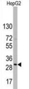 CD9 Molecule antibody, abx028338, Abbexa, Western Blot image 