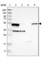 Aldehyde Dehydrogenase 3 Family Member A2 antibody, NBP1-90193, Novus Biologicals, Western Blot image 