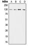 Colony Stimulating Factor 2 Receptor Beta Common Subunit antibody, LS-C352046, Lifespan Biosciences, Western Blot image 