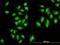 Symplekin antibody, H00008189-M03, Novus Biologicals, Immunocytochemistry image 