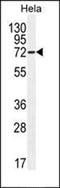 NFKB Inhibitor Alpha antibody, orb214310, Biorbyt, Western Blot image 