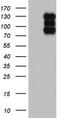 Histone Deacetylase 4 antibody, TA805058, Origene, Western Blot image 