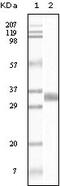 TGF beta antibody, 32-224, ProSci, Enzyme Linked Immunosorbent Assay image 