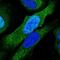Proteasome 26S Subunit, ATPase 6 antibody, NBP2-13822, Novus Biologicals, Immunocytochemistry image 