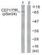 Transferrin Receptor antibody, P30443, Boster Biological Technology, Western Blot image 