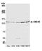 Ubiquitination Factor E4B antibody, A301-123A, Bethyl Labs, Western Blot image 