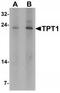 Tumor Protein, Translationally-Controlled 1 antibody, TA319724, Origene, Western Blot image 