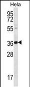 BTG Anti-Proliferation Factor 3 antibody, PA5-48438, Invitrogen Antibodies, Western Blot image 