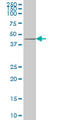 Dickkopf WNT Signaling Pathway Inhibitor 1 antibody, LS-C105117, Lifespan Biosciences, Western Blot image 