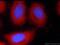 Equatorin antibody, 23168-1-AP, Proteintech Group, Immunofluorescence image 
