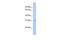 Tetraspanin 12 antibody, GTX46389, GeneTex, Western Blot image 