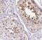 Large Tumor Suppressor Kinase 1 antibody, FNab04708, FineTest, Immunohistochemistry paraffin image 