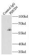 Programmed Cell Death 4 antibody, FNab06239, FineTest, Immunoprecipitation image 