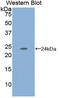 Carbonic Anhydrase 1 antibody, LS-C297458, Lifespan Biosciences, Western Blot image 