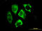 Parkin RBR E3 Ubiquitin Protein Ligase antibody, LS-C197846, Lifespan Biosciences, Immunofluorescence image 