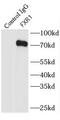 FMR1 Autosomal Homolog 1 antibody, FNab03256, FineTest, Immunoprecipitation image 