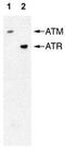 ATM Serine/Threonine Kinase antibody, ab78, Abcam, Western Blot image 