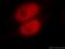 MutS Homolog 6 antibody, 18120-1-AP, Proteintech Group, Immunofluorescence image 