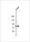 AlkB Homolog 8, TRNA Methyltransferase antibody, 62-476, ProSci, Western Blot image 