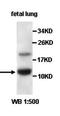 Acylphosphatase 2 antibody, orb77743, Biorbyt, Western Blot image 