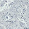 RUNX Family Transcription Factor 2 antibody, AMAb90591, Atlas Antibodies, Immunohistochemistry frozen image 