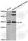 Kallikrein Related Peptidase 2 antibody, A2990, ABclonal Technology, Western Blot image 