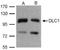 Dynein Light Chain LC8-Type 1 antibody, NBP1-31041, Novus Biologicals, Western Blot image 