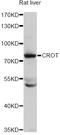 Carnitine O-Octanoyltransferase antibody, STJ23229, St John