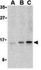 Ubiquitin Conjugating Enzyme E2 V1 antibody, GTX85082, GeneTex, Western Blot image 