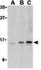 Ubiquitin-conjugating enzyme E2 variant 1 antibody, GTX85082, GeneTex, Western Blot image 