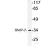 BCL2 Interacting Protein 2 antibody, LS-C291673, Lifespan Biosciences, Western Blot image 