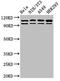 DNA mismatch repair protein Msh2 antibody, CSB-PA16889A0Rb, Cusabio, Western Blot image 