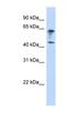 Immunoglobulin Superfamily Member 11 antibody, NBP1-59503, Novus Biologicals, Western Blot image 