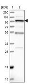 Anoctamin 3 antibody, NBP1-88546, Novus Biologicals, Western Blot image 
