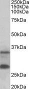 Serine/threonine-protein kinase 38 antibody, 42-877, ProSci, Western Blot image 