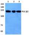 1-phosphatidylinositol-4,5-bisphosphate phosphodiesterase beta-2 antibody, A05927, Boster Biological Technology, Western Blot image 