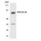Protein Phosphatase 2 Scaffold Subunit Abeta antibody, LS-C200515, Lifespan Biosciences, Western Blot image 