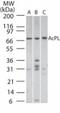 Interleukin 18 Receptor Accessory Protein antibody, TA336356, Origene, Western Blot image 
